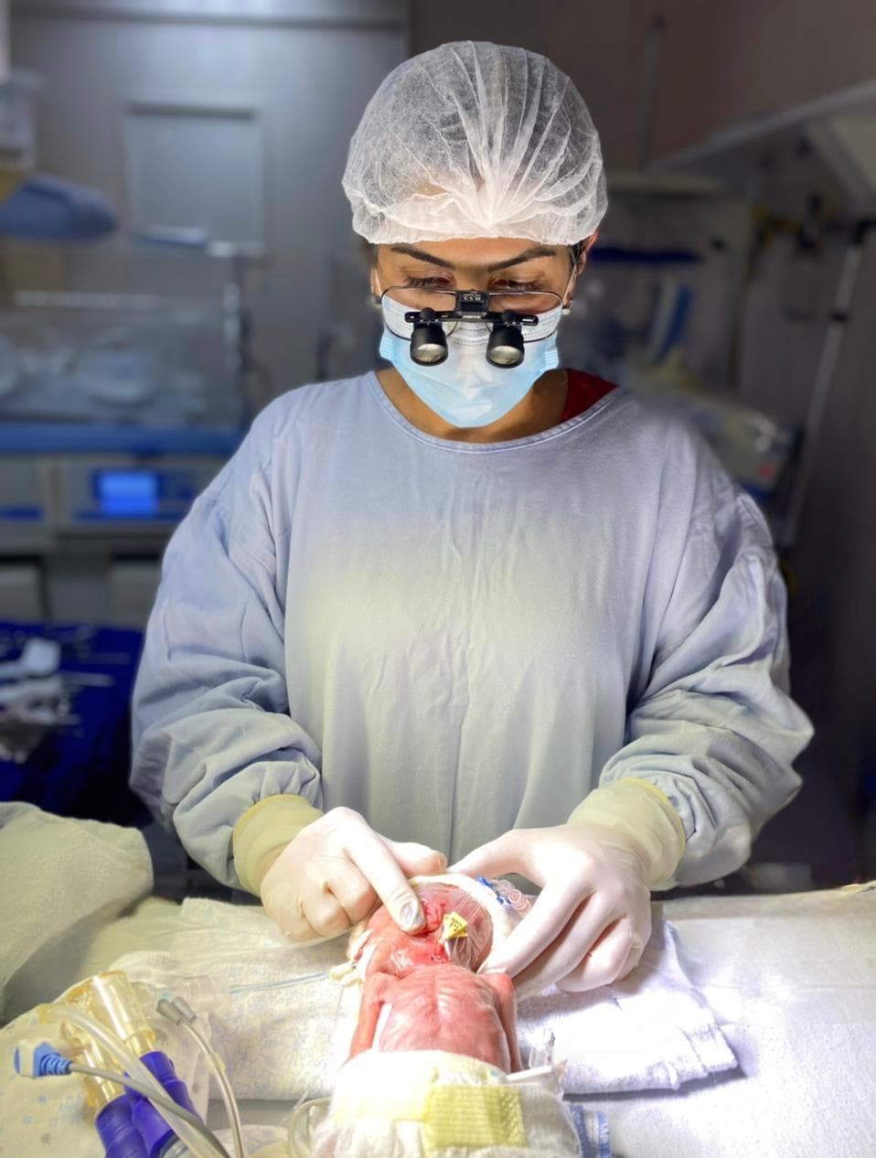 Dra. Karimy Mehanna em cirurgia neonatal, com lupas cirúrgicas, em unidade de terapia intensiva
